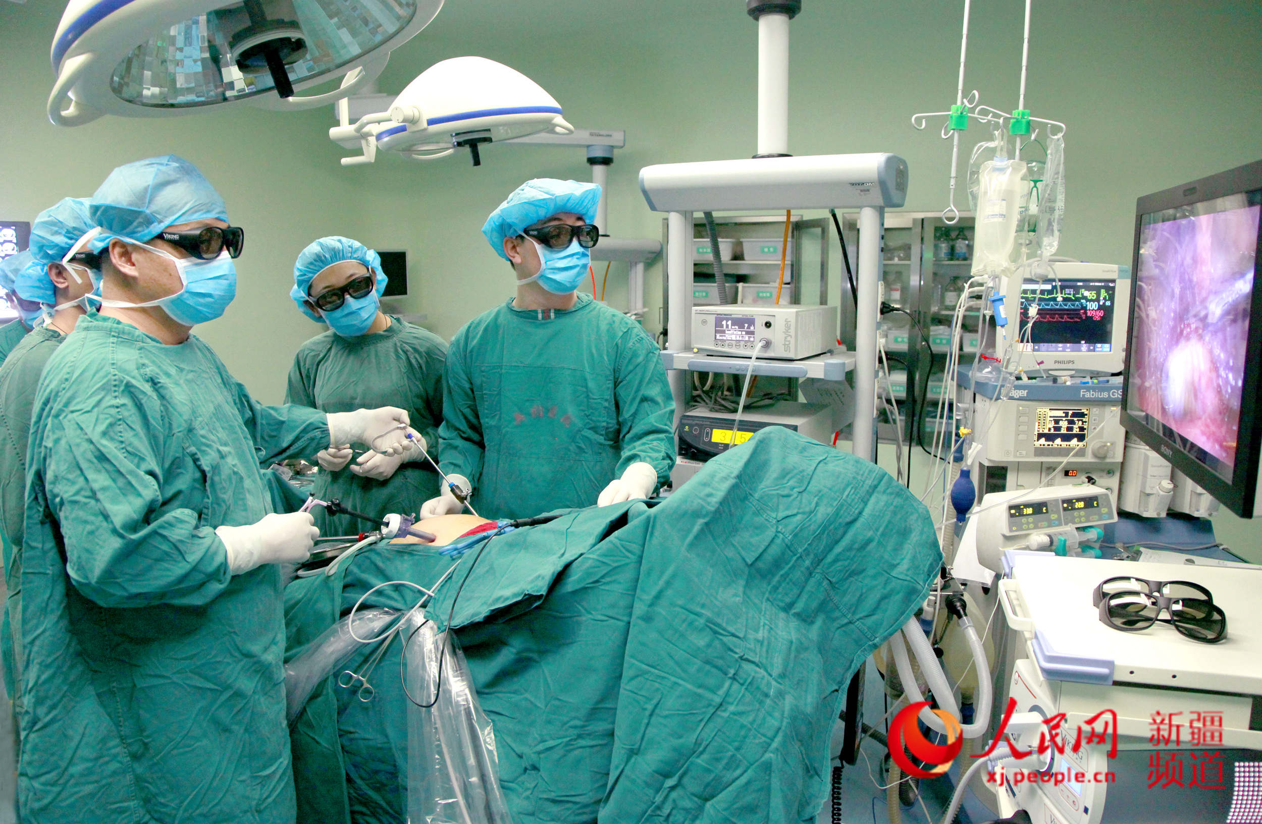 醫務人員在做3d腹腔鏡切除手術